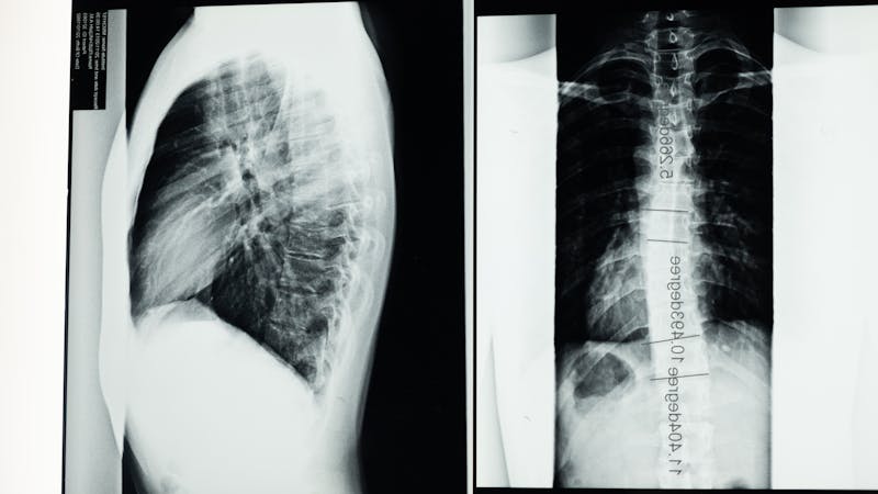 Spinal X-rays guide corrective care